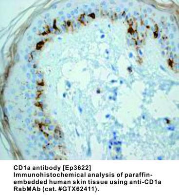 RB MAB TO CD1A