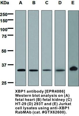 RB MAB TO XBP1