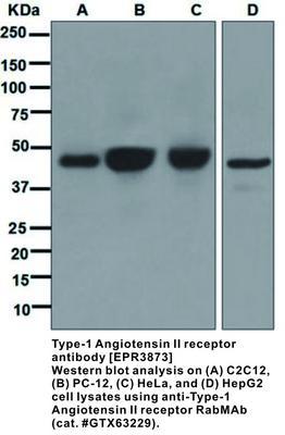 RB MAB TO TYPE-1 ANGIOT II REC