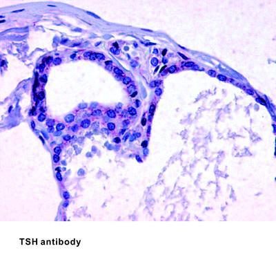 TSH antibody - 25µg, GeneTex