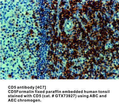 CD5 antibody [4C7] - 1ml, GeneTex