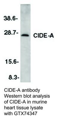 RB PAB TO CIDE-A