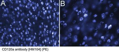 RT MAB TO CD120A