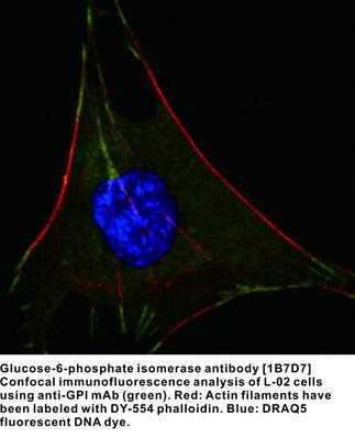 MS MAB TO GLUCOSE-6-PHOSPHATE