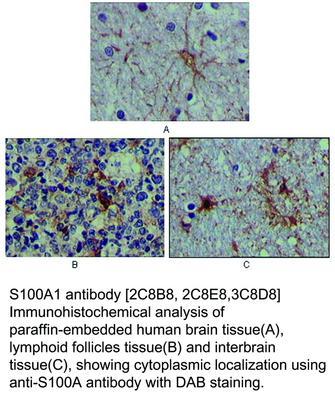 MS MAB TO S100A1