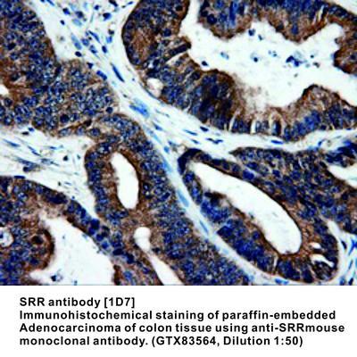 SRR antibody [1D7], GeneTex