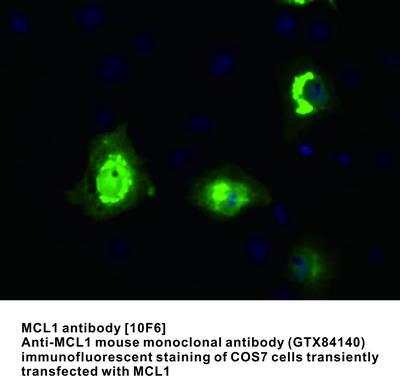 MS MAB TO MCL1