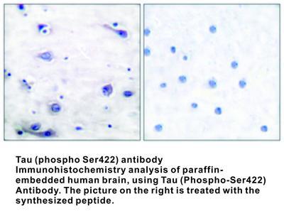 Tau (phospho Ser422) antibody, GeneTex