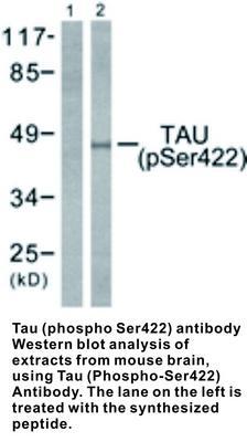 Tau (phospho Ser422) antibody, GeneTex