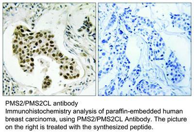 RB PAB TO PMS2/PMS2CL