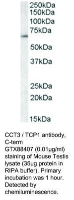 GT PAB TO CCT3 / TCP1