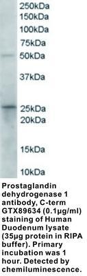 GT PAB TO PROSTAGLANDIN DEHY 1