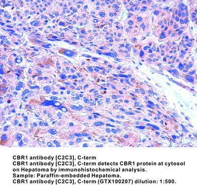 CBR1 antibody [C2C3], C-term, GeneTex