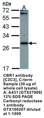 CBR1 antibody [C2C3], C-term, GeneTex