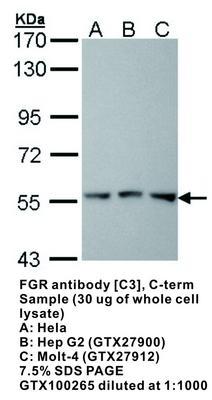 FGR antibody [C3], C-term, GeneTex