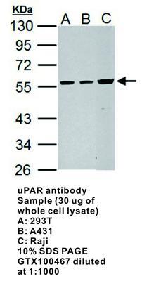 uPAR antibody, GeneTex