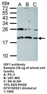 IGF1 antibody - 100µl, GeneTex