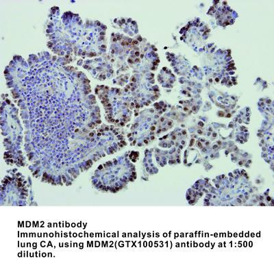 MDM2 antibody - 100µl, GeneTex