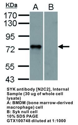 SYK antibody [N2C2], Internal, GeneTex