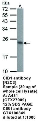 CIB1 antibody [N2C3], GeneTex