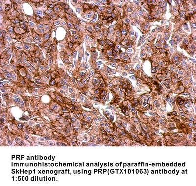 PRP antibody, GeneTex