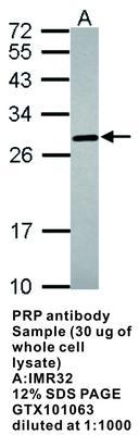 PRP antibody, GeneTex