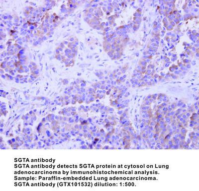 SGTA antibody [N1C3], GeneTex