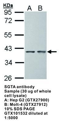 SGTA antibody [N1C3], GeneTex