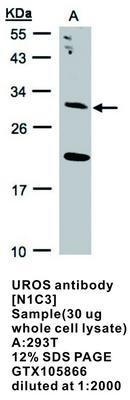 UROS antibody [N1C3], GeneTex