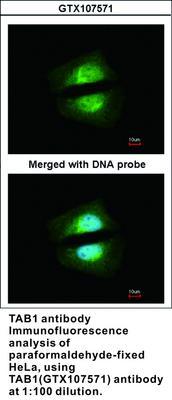 TAB1 antibody [N1C1-2], GeneTex