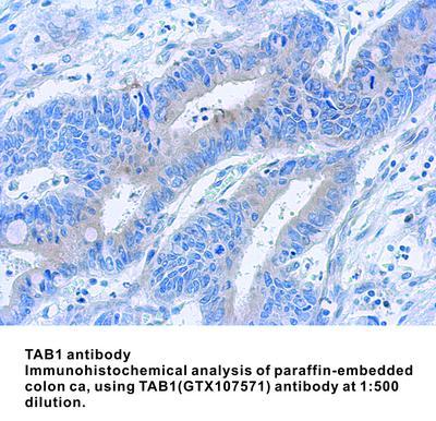 TAB1 antibody [N1C1-2], GeneTex