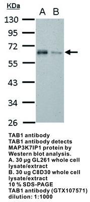 TAB1 antibody [N1C1-2], GeneTex