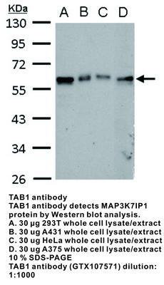 TAB1 antibody [N1C1-2], GeneTex