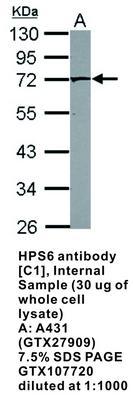 PAK4 antibody [C1C3], GeneTex