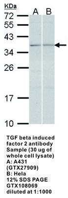 RB PAB TO TGF B INDUCED FAC 2