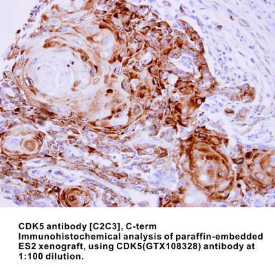 CDK5 antibody [C2C3], C-term, GeneTex