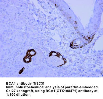 BCA1 antibody [N3C3], GeneTex