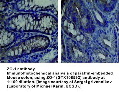 ZO-1 antibody, GeneTex