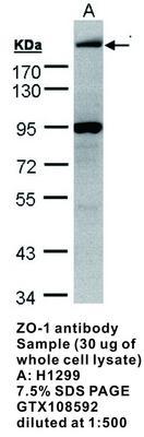 ZO-1 antibody, GeneTex