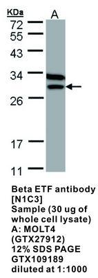 Beta ETF antibody [N1C3], GeneTex