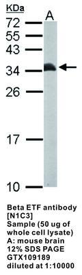 Beta ETF antibody [N1C3], GeneTex