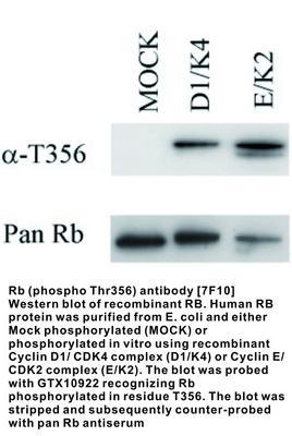 Rb (phospho Thr356) antibody [7F10], GeneTex