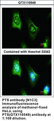 PTS antibody [N1C3], GeneTex