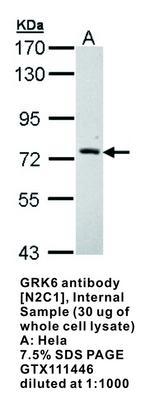 GRK6 antibody [N2C1], Internal, GeneTex