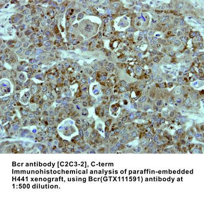 Bcr antibody [C2C3-2], C-term, GeneTex