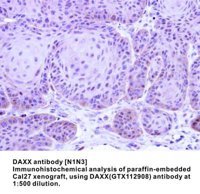 DAXX antibody [N1N3], GeneTex