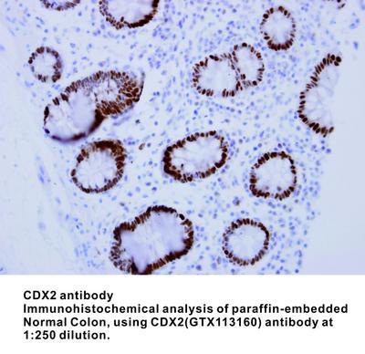 CDX2 antibody - 100µl, GeneTex