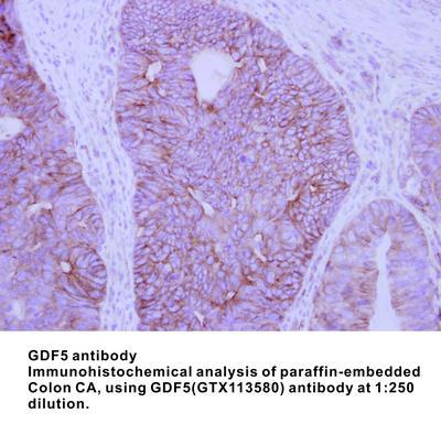 GDF5 antibody, GeneTex