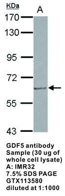 GDF5 antibody, GeneTex