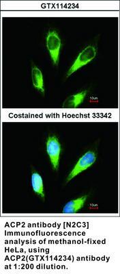 ACP2 antibody [N2C3], GeneTex